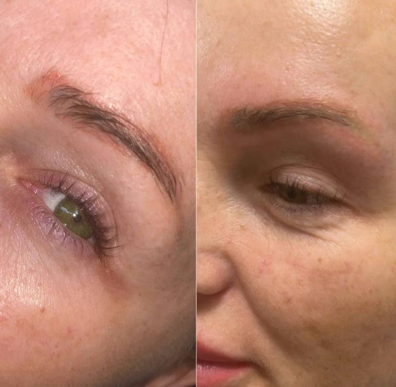 Vitrier Moissy Cramayel | How Long Does It Take to Heal After Eyebrow Tattoo Removal? Give Your Skin Time — It’s Worth It