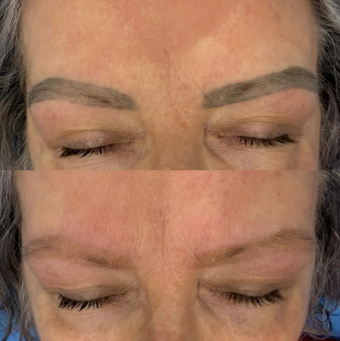 Vitrier Moissy Cramayel | How Long Does It Take to Heal After Eyebrow Tattoo Removal? Healing After Tattoo Removal, The First Week