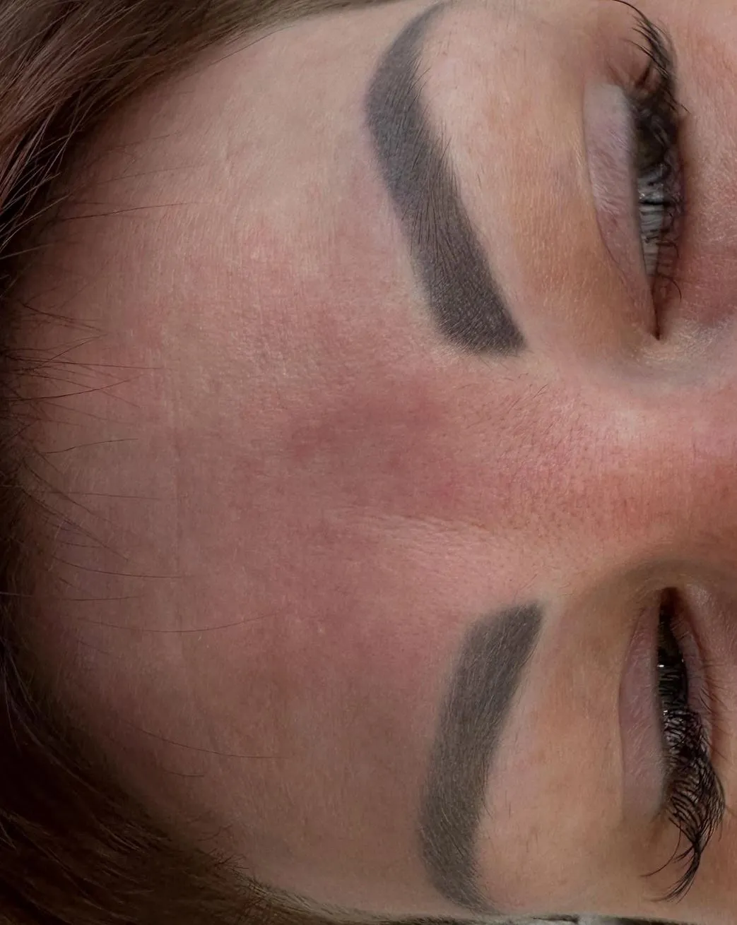 Vitrier Moissy Cramayel | How Long Does It Take to Heal After Eyebrow Tattoo Removal? Is Scarring Common After Removal