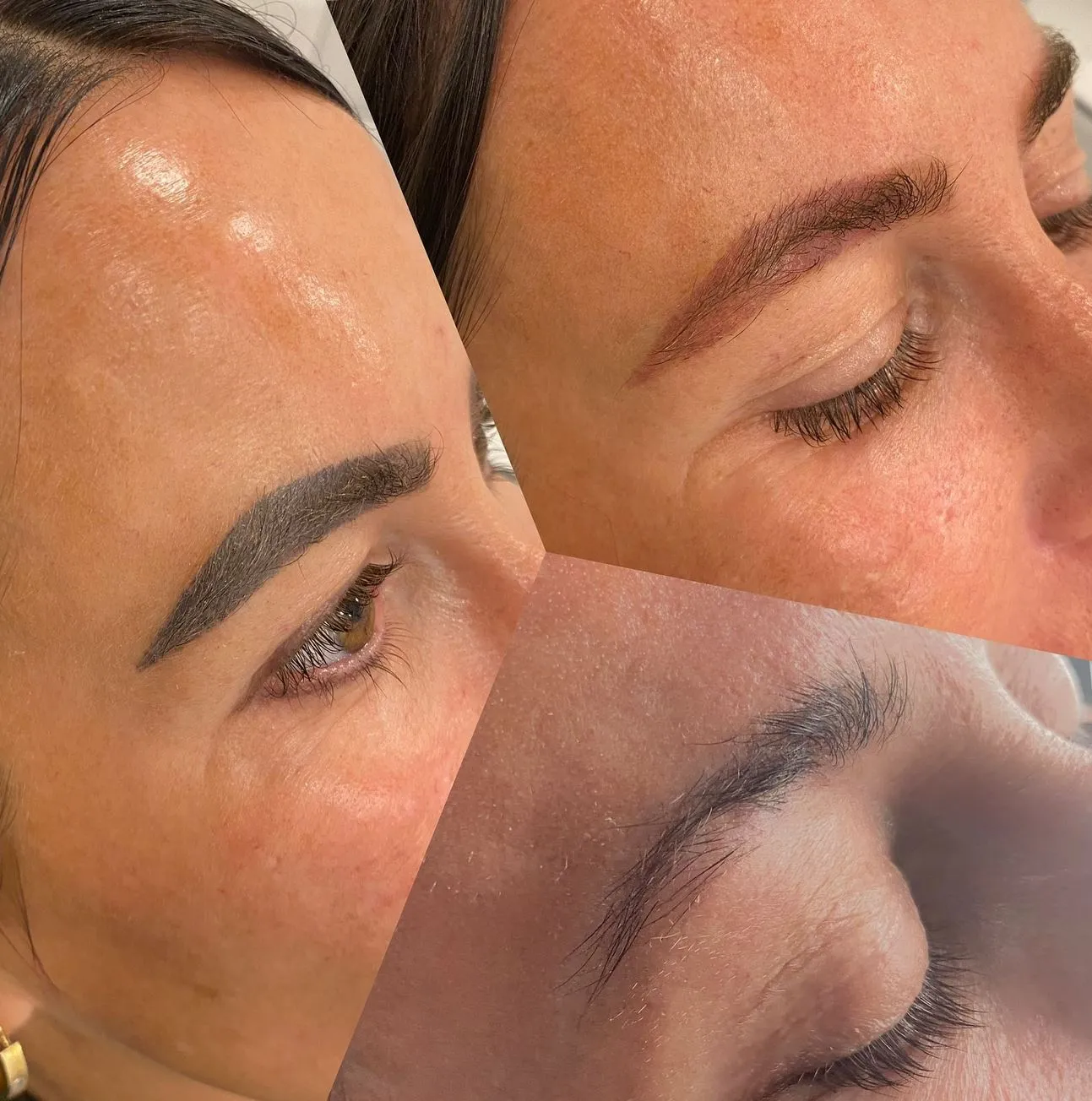 Vitrier Moissy Cramayel | How Long Does It Take to Heal After Eyebrow Tattoo Removal? What Aftercare Should You Follow