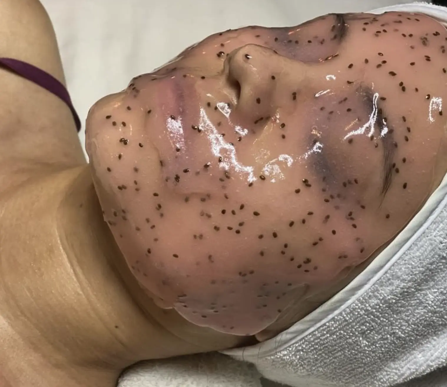 What Helps Redness And Rosacea-Like Flushing (And What Should I Avoid)?