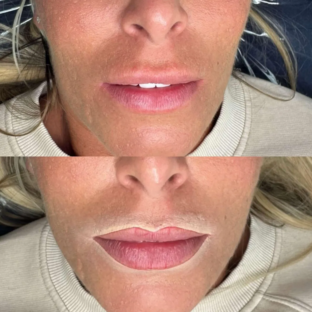 Vitrier Moissy Cramayel | What Will You Learn in a Lip Tattoo Course? lip tattoo course